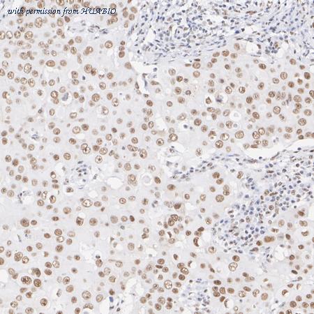 HUABIO ET1703-99 image 2