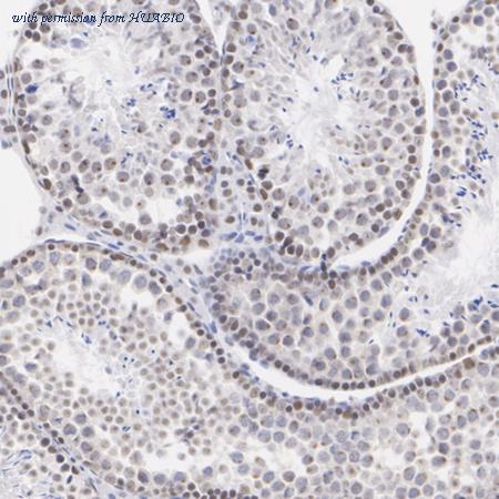 HUABIO ET1703-99 image 3