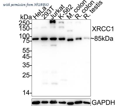 HUABIO ET1704-01 image 1