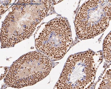 HUABIO ET1704-01 image 2