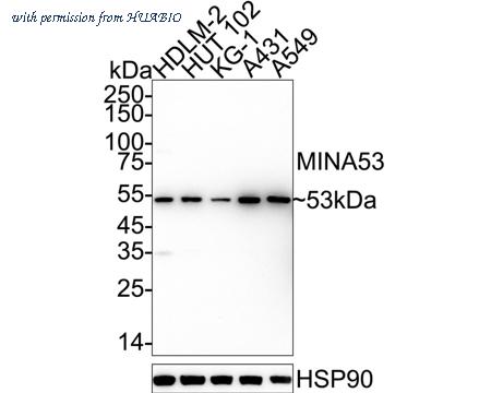HUABIO ET1704-07 image 1