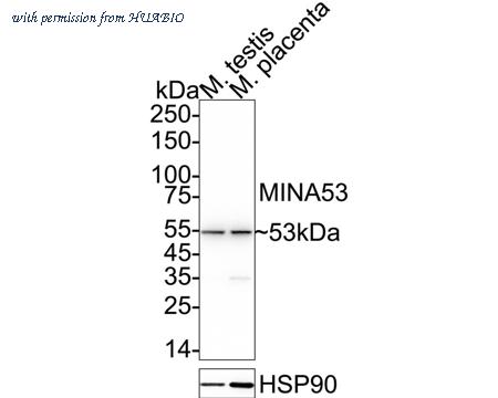 HUABIO ET1704-07 image 2