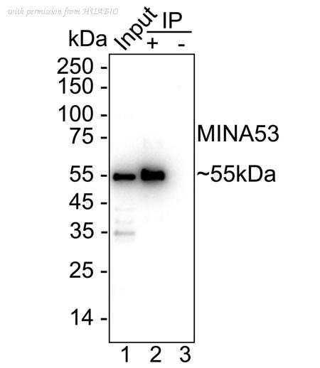 HUABIO ET1704-07 image 3