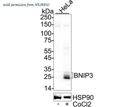 HUABIO ET1704-08 image 1