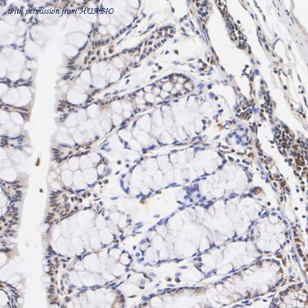 HUABIO ET1704-19 image 2