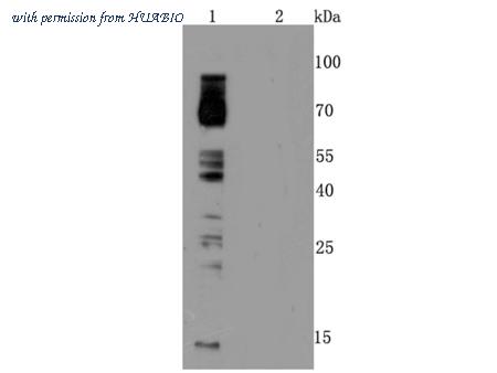 HUABIO ET1704-20 image 1