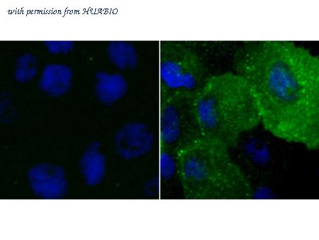 HUABIO ET1704-20 image 2