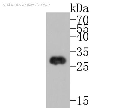 HUABIO ET1704-21-50UL image 1