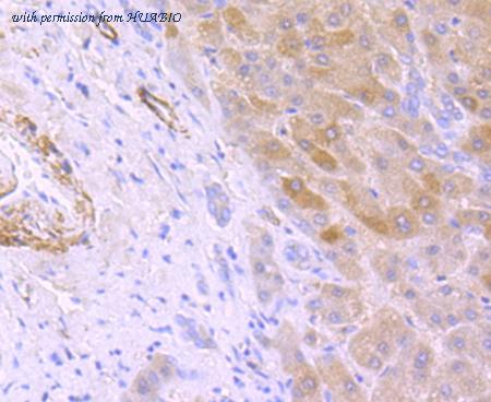 HUABIO ET1704-22 image 1