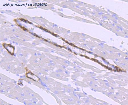 HUABIO ET1704-22 image 2