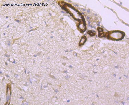 HUABIO ET1704-22 image 3