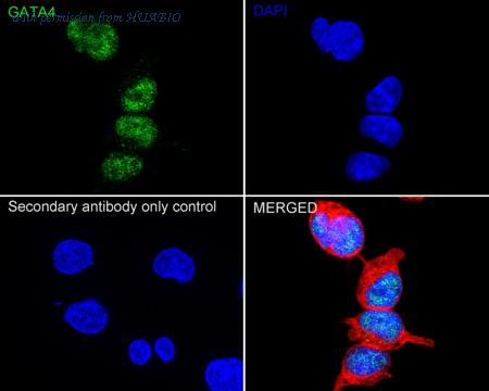 HUABIO ET1704-32 image 2