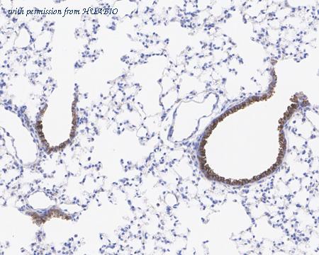 HUABIO ET1704-35 image 1