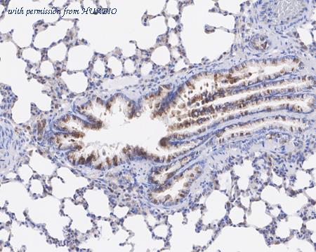 HUABIO ET1704-35 image 2