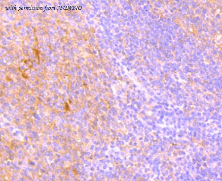 HUABIO ET1704-55 image 2