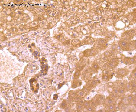 HUABIO ET1704-55 image 3