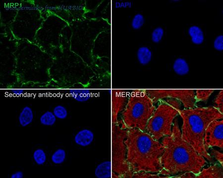 HUABIO ET1704-56 image 3