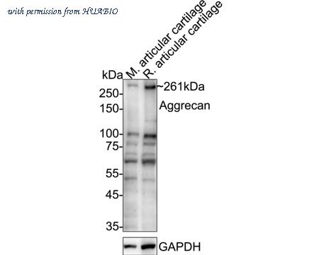 HUABIO ET1704-57 image 1