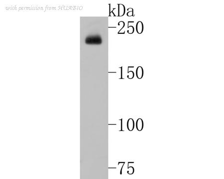 HUABIO ET1704-68 image 1