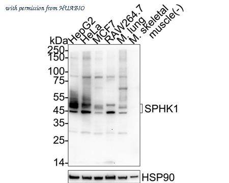 HUABIO ET1704-76 image 1