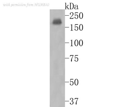 HUABIO ET1704-80 image 1