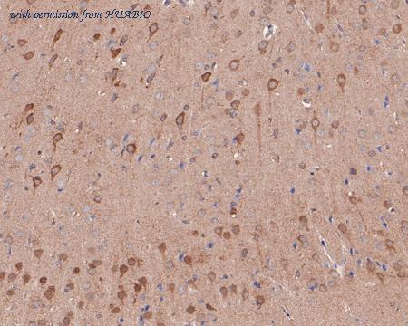 HUABIO ET1704-80 image 2