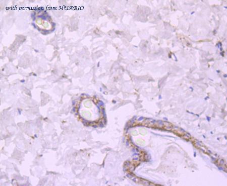 HUABIO ET1704-80 image 3