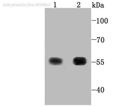 HUABIO ET1704-81 image 1