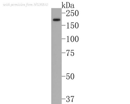 HUABIO ET1704-83 image 1