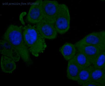 HUABIO ET1704-83 image 3