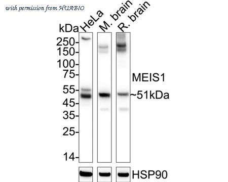 HUABIO ET1704-84 image 1