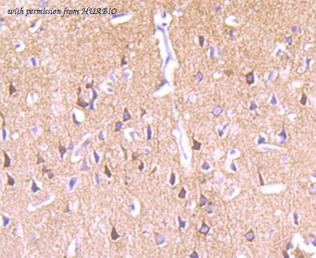 HUABIO ET1704-85 image 2