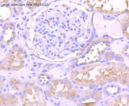 HUABIO ET1704-85 image 3