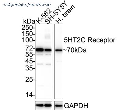 HUABIO ET1704-87 image 1