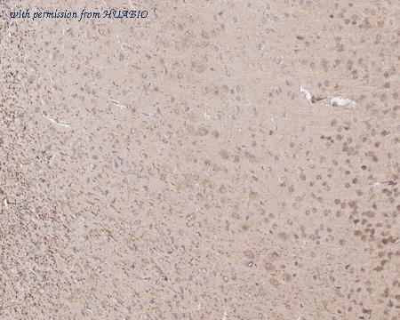 HUABIO ET1704-87 image 2