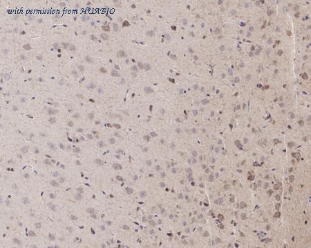 HUABIO ET1704-87 image 3