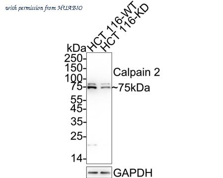 HUABIO ET1704-90 image 1