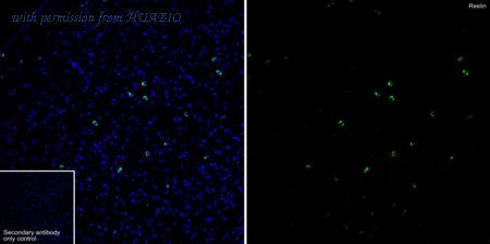 HUABIO ET1704-98 image 1