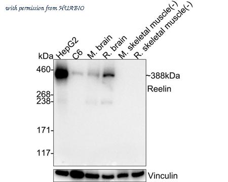 HUABIO ET1704-98 image 2