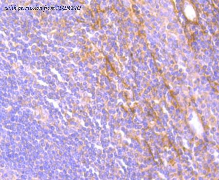 HUABIO ET1705-1 image 3