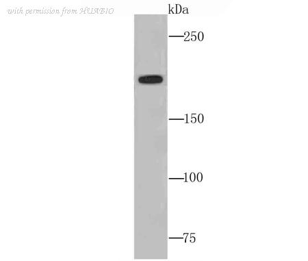 HUABIO ET1705-10 image 1