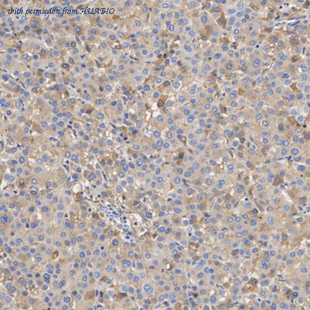 HUABIO ET1705-10 image 3