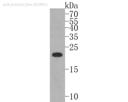 HUABIO ET1705-15-50UL image 1