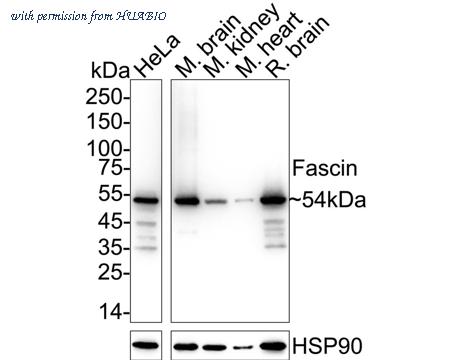 HUABIO ET1705-18 image 1