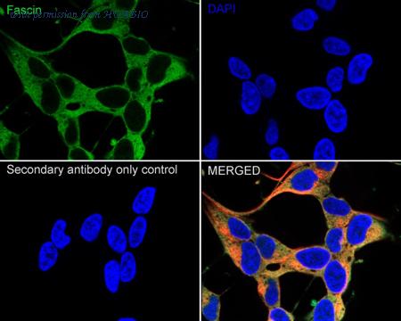 HUABIO ET1705-18 image 3