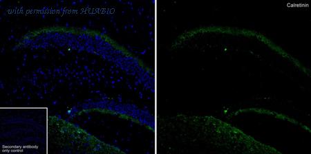 HUABIO ET1705-19 image 1