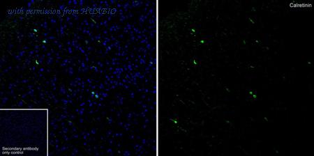 HUABIO ET1705-19 image 2