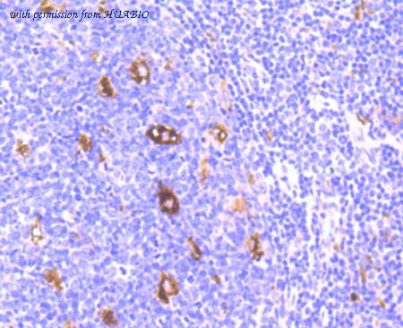 HUABIO ET1705-47 image 2