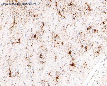 HUABIO ET1705-48 image 3