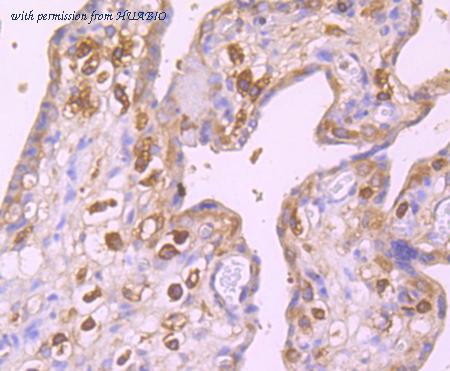 HUABIO ET1705-53 image 3